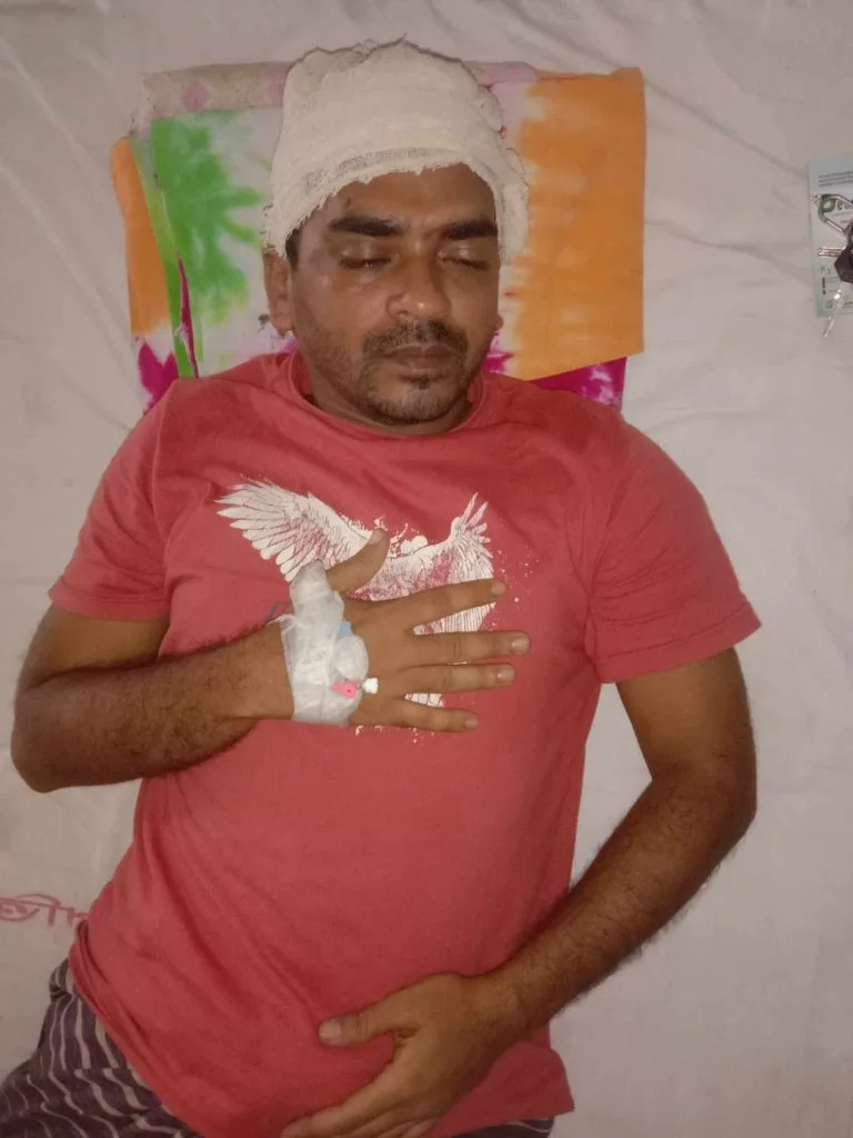 কলাপাড়ায় ইউপি নির্বাচনে হাতপাখা প্রার্থীর সমর্থন না করায় যুবককে মারধরের অভিযোগ