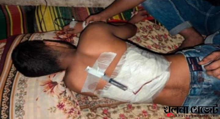 ‘গণঅভ্যুত্থানে আহত নাঈমের শরীরে গুলির স্প্রিন্টারের যন্ত্রণা আজীবন ভোগ করতে হবে’